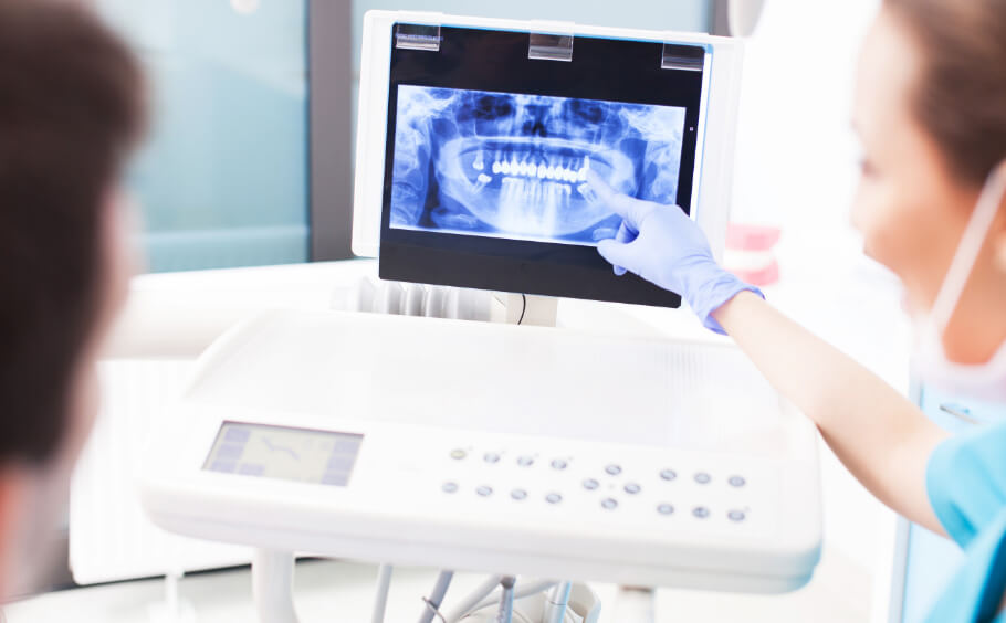 Digital-X-Rays