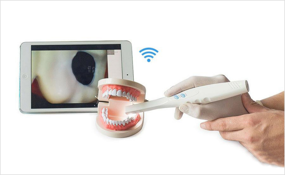 Intra-Oral-Camera